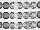 Melosira cell division